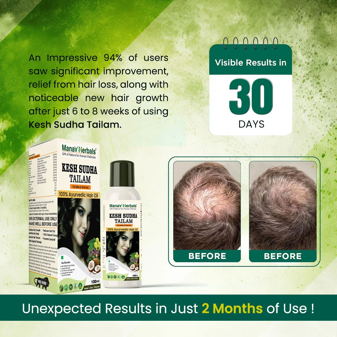 Kesh Sudha Tailam Kit, incuding 100ml Pure Ayrvedic Hair Oil With 30 Ayurvedic Capsules For Strong & Healthy Hair For Men & Women