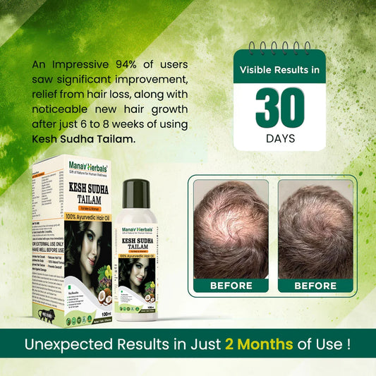 Kesh Sudha Tailam Kit, incuding 100ml Pure Ayrvedic Hair Oil With 30 Ayurvedic Capsules For Strong & Healthy Hair For Men & Women